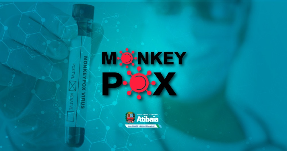 Atibaia atualiza situação de casos de varíola dos macacos